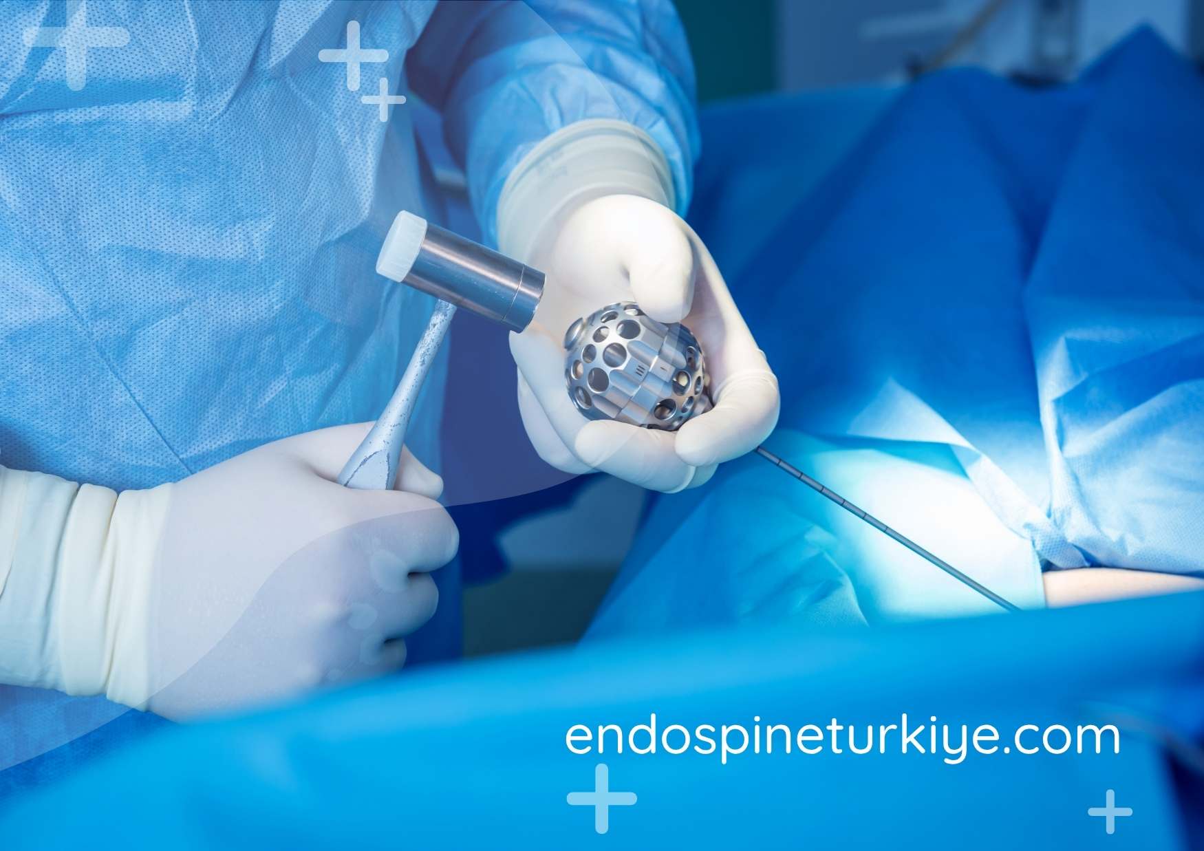 Endoskopik giriş noktası - HD kamera ile görüntüleme