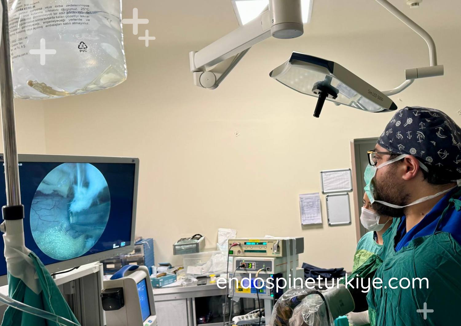 Endoskopik görüntüleme cihazı - HD cerrahi kamera sistemi