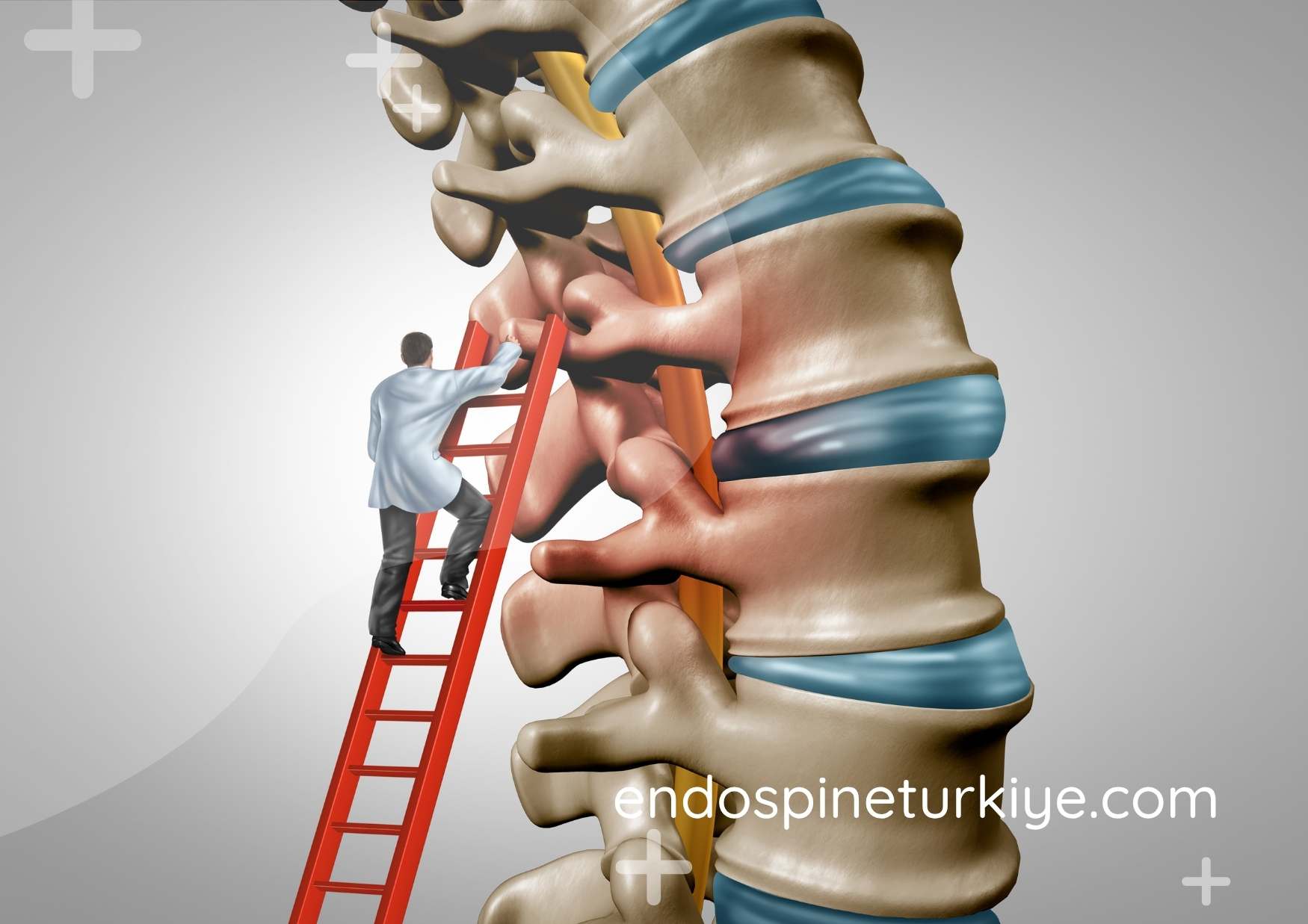 Omurga cerrahisi detay - cerrahi prosedür görüntüsü
